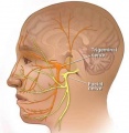 Facial nerve.jpg